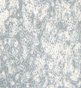 A-204 [A204]人橫紋肌肉瘤細胞主圖