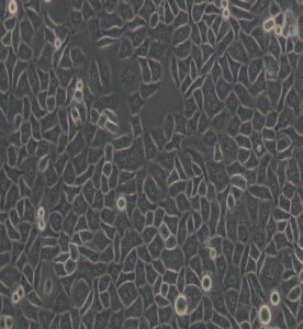 Bcap-37人乳腺癌細(xì)胞主圖