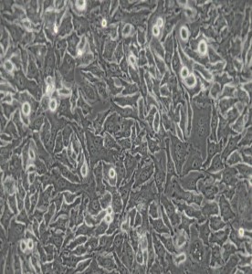 Hela-299人宮頸癌細胞主圖