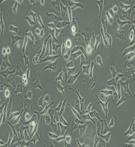 CNE人鼻咽癌細(xì)胞主圖