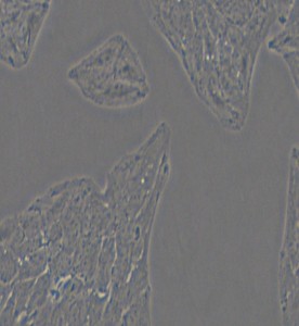 Li-7人肝癌細胞主圖