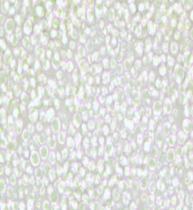 OKT 11小鼠雜交瘤細胞(抗CD2)主圖