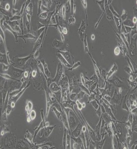 PC-3人前列腺癌細胞主圖