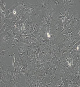RBE人肝膽管癌細胞主圖