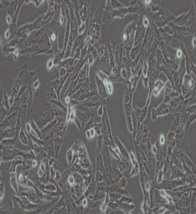 SK-N-SH人神經(jīng)母細胞瘤細胞主圖