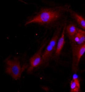 大鼠視網膜Muller細胞主圖