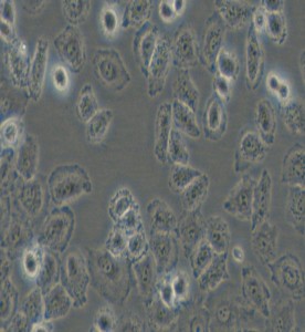 NCI-H838人非小細(xì)胞肺癌細(xì)胞主圖