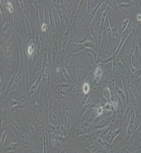 SW 1353人軟骨肉瘤細胞(DMEM） 主圖
