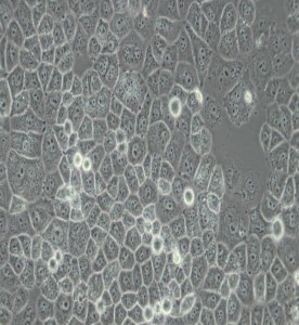 SW-13人腎上腺皮質(zhì)小細胞癌細胞(DMEM)主圖