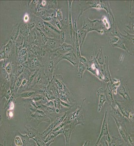 WPMY-1人正常前列腺基質永生化細胞主圖