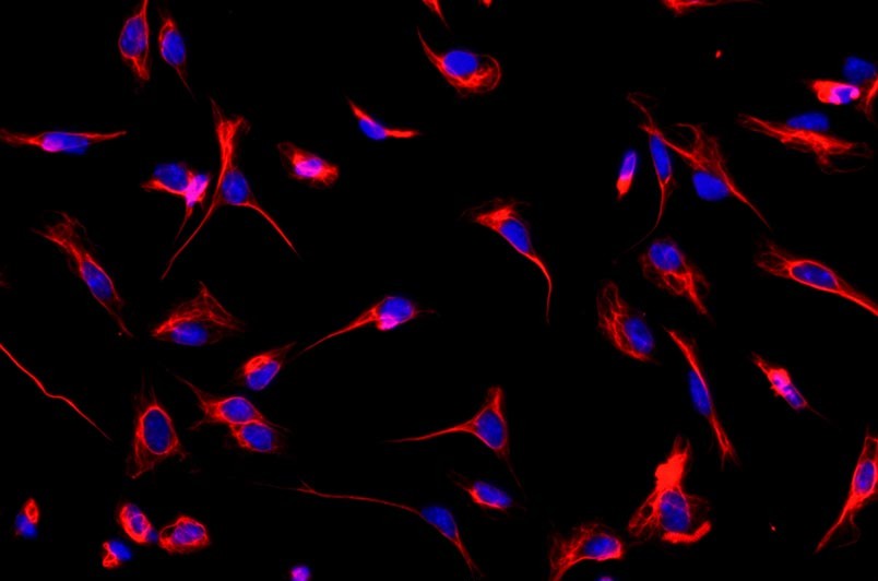 小鼠心肌成纖維細胞主圖