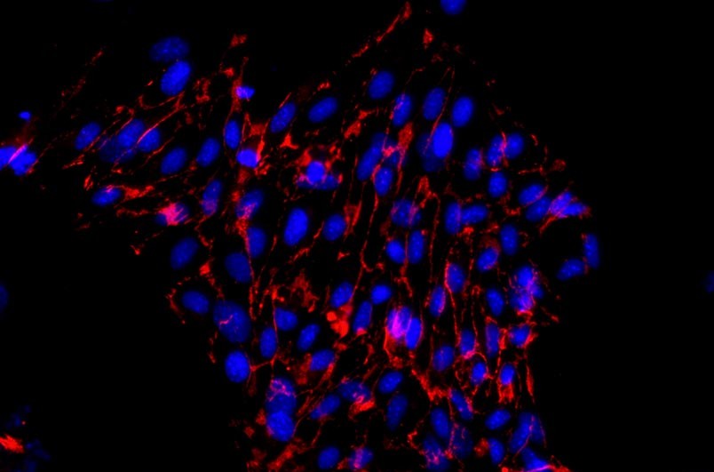 小鼠主動脈內皮細胞主圖