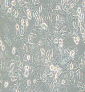 Anglne人卵巢癌細胞主圖