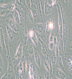 Caki-2人乳頭狀腎細(xì)胞癌細(xì)胞主圖