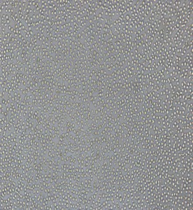 CoC1人卵巢癌細(xì)胞主圖