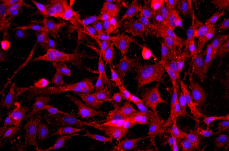 小鼠海綿體內皮細胞主圖