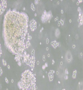 Farage人B淋巴瘤細胞主圖