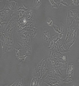 HT-1080[HT1080]人纖維肉瘤細胞主圖
