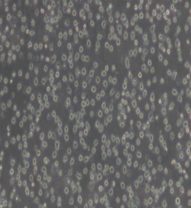 JeKo-1人套細(xì)胞淋巴瘤細(xì)胞主圖