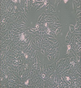 MDA-MB-361人乳腺癌細胞(DMEM) 主圖