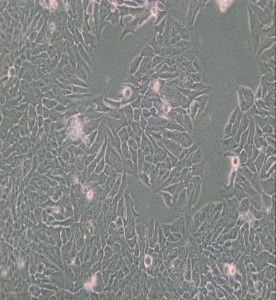 MDA-MB-361人乳腺癌細胞(L15) 主圖