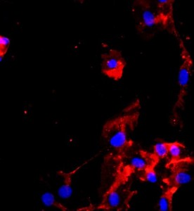 人臍動脈內皮細胞主圖