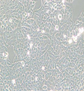 Hela-229人宮頸癌細(xì)胞主圖