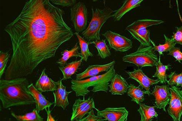 免疫熒光雙標三色染色主圖